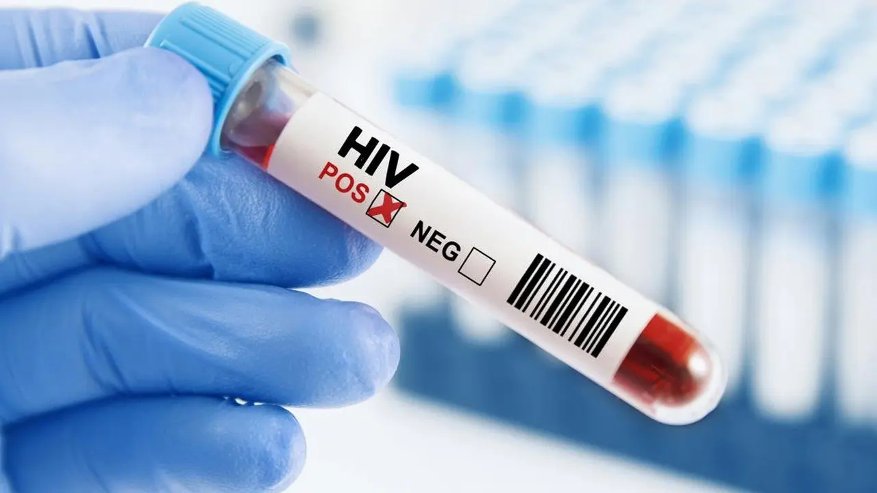 Waspada HIV/AIDS di Lebak: 85 Kasus Tercatat, 3 Nyawa Melayang